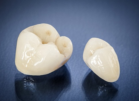 Two types of ceramic dental crowns sitting on a table next to each other
