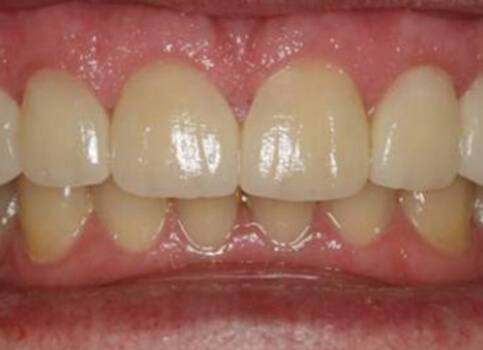 White healthy smile after dental treatment