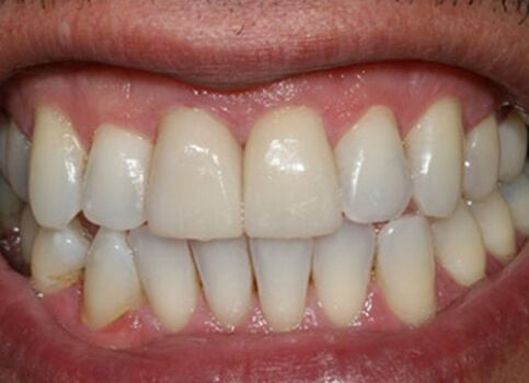 Healthy beautiful smile after cosmetic dentistry