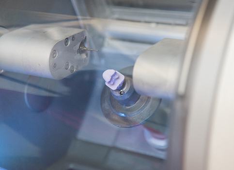 An up-close look at how a milling unit creates a dental crown during a single appointment