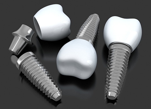 Three animated dental implant restorations