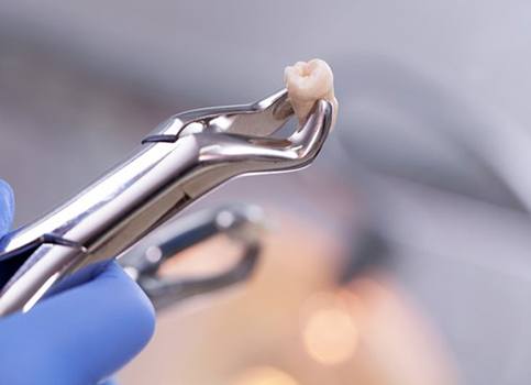 dentist holding an extracted tooth with a dental instrument 