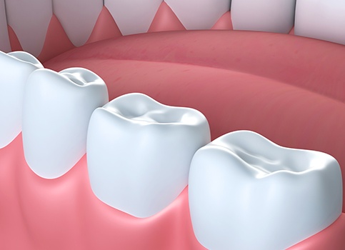 Animated smile with tooth colored filling