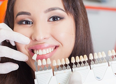 Patient's smile compared with porcelain veneer shade chart