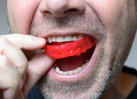 man putting on mouthguard