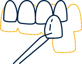Animated smile during cosmetic dentistry