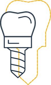 Animated dental implant supported dental crown