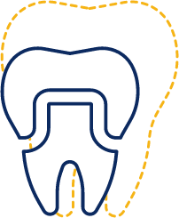 Animated tooth with dental crown signifying restorative dentistry