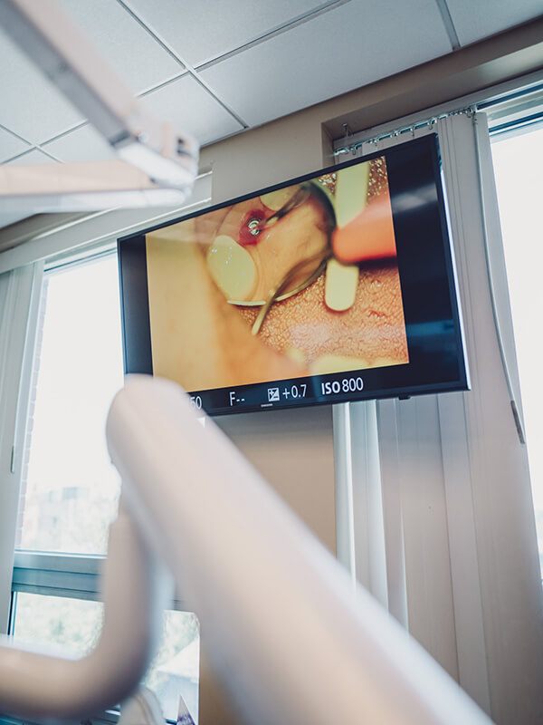 Patient's dental treatment viewed on chairside computer monitor