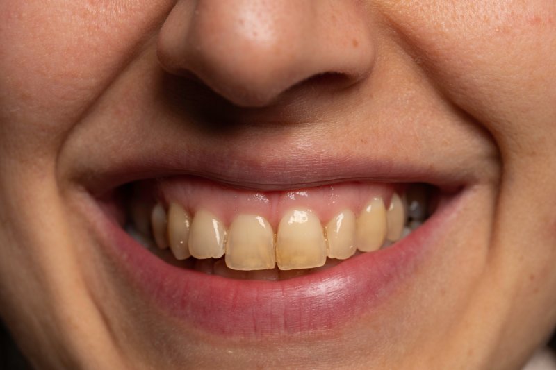 close-up of a yellow smile